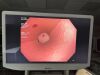 OLYMPUS CF-H180AL Colonoscope