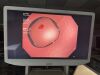 OLYMPUS CF-H180AL Colonoscope