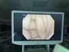 OLYMPUS PCF-H180AL Colonoscope