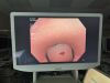 OLYMPUS PCF-H180AL Colonoscope
