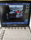 GE Logiq E Ultrasound System