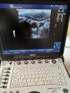 GE Logiq E Ultrasound System