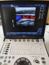 GE Logiq E Ultrasound System