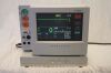 DYNASCOPE Fukuda Denshi DS-5100E Display and Battery oct24 #3 Display Monitor