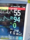 PHILIPS Intellivue MP30 Anesthesia Patient Monitor