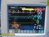 PHILIPS Intellivue MP30 Anesthesia Patient Monitor