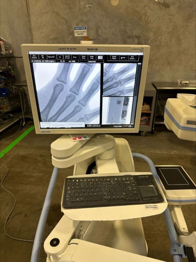 HOLOGIC Fluoroscan® InSight-FD C-Arm