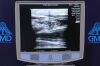 ZONARE Z1 St. Jude  Z.One SmartCart Diagnostic Ultrasound System