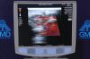 ZONARE Z1 St. Jude  Z.One SmartCart Diagnostic Ultrasound System