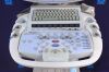 ZONARE Z.One St. Jude Medical   SmartCart Ultrasound System