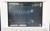 PHILIPS M1205A Monitor
