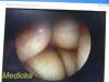 ARTHREX AR-3350-4070H Arthrex AR-3350-4070H Hip Arthroscope