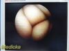 ARTHREX AR-3355-4070H C-Mount Hip HD Arthroscope | 70° | 3.5 x 204mm