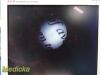 OLYMPUS LF-TP Tracheal Intubation Fiber Scope W/ MAJ-524 Light Source