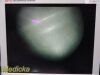 Guidant Ref 11333 Rigid Telescope 5mm x 70º | Vascular Ligation Scope
