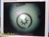Guidant Ref 11333 Rigid Telescope 5mm x 70º | Vascular Ligation Scope