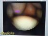 Guidant Ref 11333 Rigid Telescope 5mm x 70º | Vascular Ligation Scope