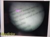 Guidant Ref 11333 Rigid Telescope 5mm x 70º | Vascular Ligation Scope