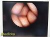 ARTHREX AR-3355-4030H C-Mount Hip ; HD | 30° | 3.5 x 202mm ~ Arthroscope