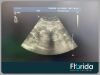 PHILIPS C5-1 PUREWAVE ULTRASOUND TRANSDUCER PROBE- 453561224465 Ultrasound Transducer