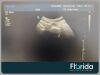 PHILIPS C5-1 CONVEX PUREWAVE ULTRASOUND TRANSDUCER PROBE REF 453561224469 TESTED 30 DAYS WARRANTY Ultrasound Transducer