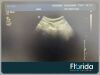 PHILIPS C5-1 CONVEX PUREWAVE ULTRASOUND TRANSDUCER PROBE REF 453561224469 TESTED 30 DAYS WARRANTY Ultrasound Transducer