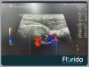 GE 2013 RSP6-16-D TRANSDUCER PROBE REF H48651MR 3D 4D TESTED *EXCELLENT CONDITION* 30 DAYS WARRANTY Ultrasound Transducer