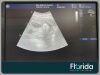 GE 2020 E8C 2D ENDOCAVITY TRANSDUCER PROBE REF 2297883 30 DAYS WARRANTY Ultrasound Transducer