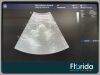 GE 2020 E8C 2D ENDOCAVITY TRANSDUCER PROBE REF 2297883 30 DAYS WARRANTY Ultrasound Transducer