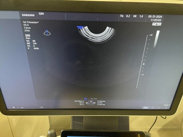 SAMSUNG HS50 2019   Ultrasound System w/ V59, CA9AD