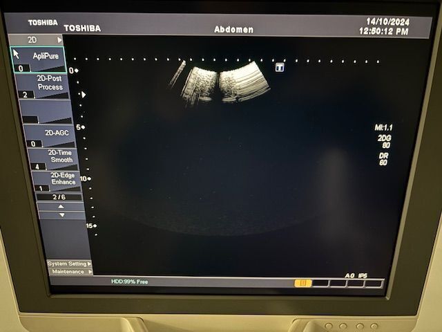 TOSHIBA Xario Ultrasound - Shared Service