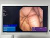 OLYMPUS TJF-160VR Duodenoscope Endoscope