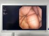 OLYMPUS TJF-160VR Duodenoscope Endoscope