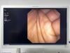 OLYMPUS TJF-160VR Duodenoscope Endoscope