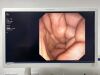 OLYMPUS TJF-160VR Duodenoscope Endoscope