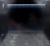 HITACHI NOBLUS Ultrasound