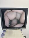 OLYMPUS CF-Q165I Colonoscope