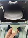 BK MEDICAL Pro Focus 2202 Ultrasound - Urology