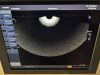 TOSHIBA Xario Ultrasound - Shared Service