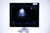 GE Vivid S6 USG Machine