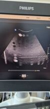 PHILIPS Epiq 5G Ultrasound - Shared Service