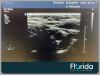 PHILIPS L11-3 LINEAR ARRAY TRANSDUCER PROBE REF 453561181021 TESTED 30 DAYS WARRANTY Ultrasound Transducer