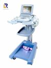 SONOSITE Titan ultrasound machine