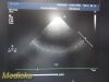 PHILIPS S8-3 Adult Cardiac Sector Array Ultrasound Transducer