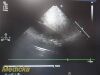 PHILIPS S8-3 Adult Cardiac Sector Array Ultrasound Transducer