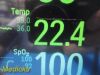 PHILIPS MP30 Anesthesia,W/ M3001A MMS Module & Leads ~   Patient Monitor