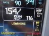 GE 2013  Dash 4000,(TEMP/CO, SpO2, ECG, NBP, CO2) W/ Leads ~ Patient Monitor