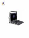 SONOSCAPE S8 ultrasound machine