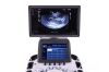 SAMSUNG UGEO G60 Ultrasound scanner