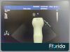 PHILIPS S8-3 SECTOR ARRAY TRANSDUCER PROBE REF 453561270603 TESTED 30 DAYS WARRANTY Ultrasound Transducer